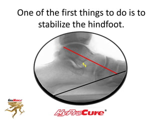 One of the first things to do is to
stabilize the hindfoot.
 