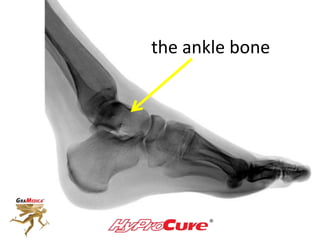 the ankle bone
 