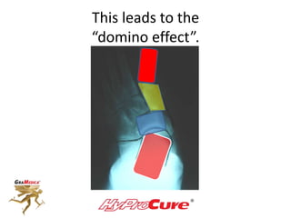 This leads to the
“domino effect”.
 