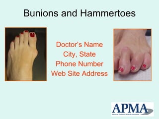 Bunions and Hammertoes Doctor’s Name City, State Phone Number Web Site Address 