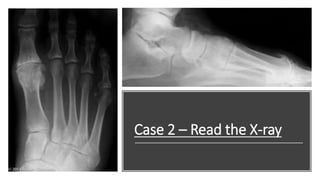 Case 2 – Read the X-ray
 