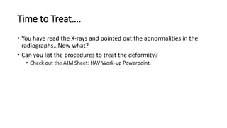 Time to Treat….
• You have read the X-rays and pointed out the abnormalities in the
radiographs…Now what?
• Can you list the procedures to treat the deformity?
• Check out the AJM Sheet: HAV Work-up Powerpoint.
 