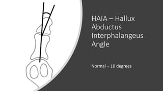 HAIA – Hallux
Abductus
Interphalangeus
Angle
Normal – 10 degrees
 