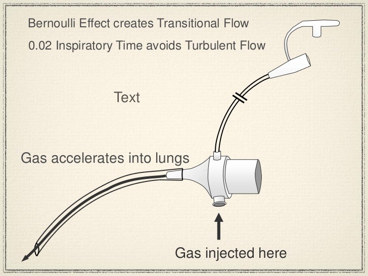 Bunnell History and High Frequency Jet Ventilator Theory