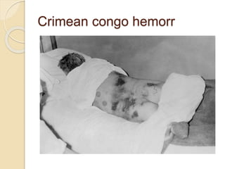 Crimean congo hemorr
 