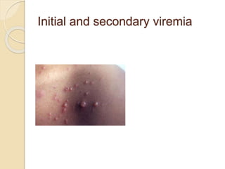 Initial and secondary viremia
 