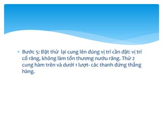  Bước 5: Đặt thử lại cung lên đúng vị trí cần đặt: vị trí
cổ răng, không làm tổn thương nướu răng. Thử 2
cung hàm trên và dưới 1 lượt- các thanh đứng thẳng
hàng.

 