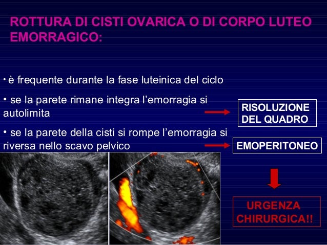 Corpo Luteo Emorragico Si Riassorbe