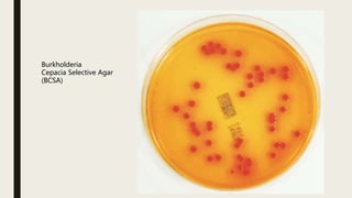 Burkholderia cepacia | PPTX