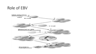 Role of EBV
 