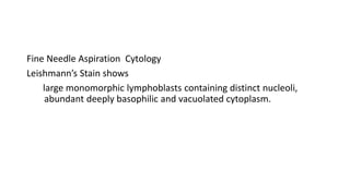 Fine Needle Aspiration Cytology
Leishmann’s Stain shows
large monomorphic lymphoblasts containing distinct nucleoli,
abundant deeply basophilic and vacuolated cytoplasm.
 