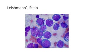 Leishmann’s Stain
 