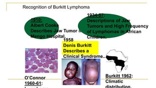 Recognition of Burkitt Lymphoma
1958
Denis Burkitt
Describes a
Clinical Syndrome..
1910:
Albert Cooke
Describes Jaw Tumor in
Mengo Hospital.
1934-57:
Descriptions of Jaw
Tumors and High Frequency
of Lymphomas in African
Children.
O’Connor
1960-61:
Burkitt 1962:
Climatic
10
 