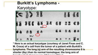 Burkitt’s Lymphoma -
Karyotype:
* Here is an actual karyotype (courtesy of Janet Finan and C.
M. Croce) of a cell from the tumor of a patient with Burkitt's
lymphoma. The long (q) arm of the resulting chromosome 8 is
shorter (8q-) than its normal homologue; the long arm of
 