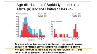 Age distribution of Burkitt lymphoma in
Africa (a) and the United States (b).
30
Jaw and orbital tumours are particularly common in young
children in African Burkitt lymphoma (fraction of patients
with jaw tumours is indicated by the red column in (a)) but
not in Burkitt lymphoma in the United States.
 