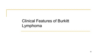Clinical Features of Burkitt
Lymphoma
32
 