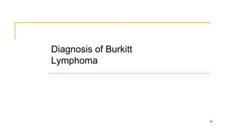 Diagnosis of Burkitt
Lymphoma
41
 