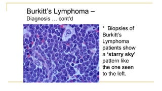 Burkitt’s Lymphoma –
Diagnosis … cont’d
* Biopsies of
Burkitt’s
Lymphoma
patients show
a ‘starry sky’
pattern like
the one seen
to the left.
 