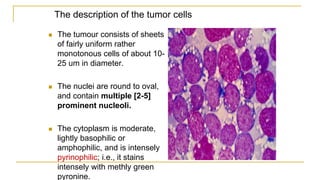 The description of the tumor cells
 The tumour consists of sheets
of fairly uniform rather
monotonous cells of about 10-
25 um in diameter.
 The nuclei are round to oval,
and contain multiple [2-5]
prominent nucleoli.
 The cytoplasm is moderate,
lightly basophilic or
amphophilic, and is intensely
pyrinophilic; i.e., it stains
intensely with methly green
pyronine.
 