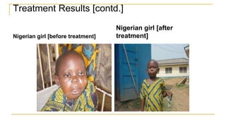Treatment Results [contd.]
Nigerian girl [before treatment]
Nigerian girl [after
treatment]
 