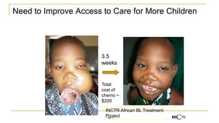 Need to Improve Access to Care for More Children
3.5
weeks
Total
cost of
chemo ~
$200
INCTR African BL Treatment
Project
64
 