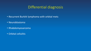 • Recurrent Burkitt lymphoma with orbital mets
• Neuroblastoma
• Rhabdomyosarcoma
• Orbital cellulitis
Differential diagnosis
 