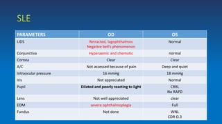 SLE
PARAMETERS OD OS
LIDS Retracted, lagophthalmos
Negative bell’s phenomenon
Normal
Conjunctiva Hyperaemic and chemotic normal
Cornea Clear Clear
A/C Not assessed because of pain Deep and quiet
Intraocular pressure 16 mmHg 18 mmHg
Iris Not appreciated Normal
Pupil Dilated and poorly reacting to light CRRL
No RAPD
Lens Not well appreciated clear
EOM severe ophthalmoplegia Full
Fundus Not done WNL
CDR O.3
 