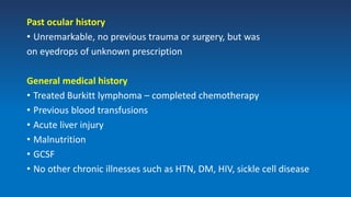 Past ocular history
• Unremarkable, no previous trauma or surgery, but was
on eyedrops of unknown prescription
General medical history
• Treated Burkitt lymphoma – completed chemotherapy
• Previous blood transfusions
• Acute liver injury
• Malnutrition
• GCSF
• No other chronic illnesses such as HTN, DM, HIV, sickle cell disease
 