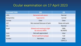 Ocular examination on 17 April 2023
PARAMETERS OD OS
LIDS Retracted with ptosis Normal
Conjunctiva hyperaemic normal
Cornea Clear Clear
A/C Not assessed because of pain Deep and quiet
Iris Not appreciated Normal
Pupil Dilated and reacting to light
No obvious RAPD
CRRL
No RAPD
Lens Not well appreciated clear
EOM Partial ophthalmoplegia Full
Fundus Not done WNL
CDR O.3
 