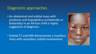 Diagnostic approaches
• An abdominal and orbital mass with
proptosis and hyperglobus (unilaterally or
bilaterally) in an African child is highly
suggestive of diagnosis.
• Orbital CT and MRI demonstrate a maxillary
mass with secondary orbital involvement.
 