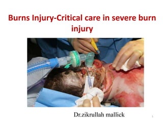 1
Burns Injury-Critical care in severe burn
injury
Dr.zikrullah mallick
 