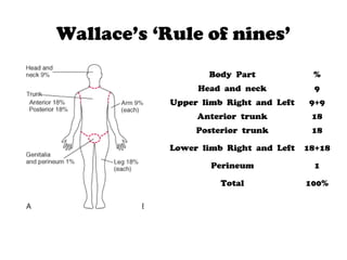 Wallace’s ‘Rule of nines’
Body Part %
Head and neck 9
Upper limb Right and Left 9+9
Anterior trunk 18
Posterior trunk 18
Lower limb Right and Left 18+18
Perineum 1
Total 100%
 