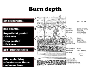 Burn depth
1st : superficial
2nd : partial
Superficial partial
thickness
Deep partial
thickness
3rd : full thickness
4th : underlying
subcutaneous tissue,
tendon or bone
 