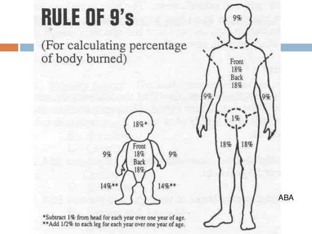 Burn Percentage Chart Rule Of 9