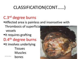 CLASSIFICATION(CONT……)
C.3rd degree burns
Affected area is painless and insensetive with
Thrombosis of superficial
vessels
It requires grafting
D.4th degree burns
It involves underlying
Tissues
Muscles
bones10/22/2016 10
 