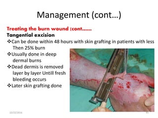 Management (cont…)
Treating the burn wound (cont……
Tangential excision
Can be done within 48 hours with skin grafting in patients with less
Then 25% burn
Usually done in deep
dermal burns
Dead dermis is removed
layer by layer Untill fresh
bleeding occurs
Later skin grafting done
10/22/2016 45
 