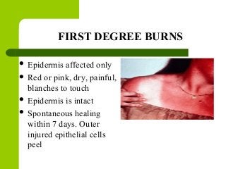 FIRST DEGREE BURNS
 Epidermis affected only
 Red or pink, dry, painful,
blanches to touch
 Epidermis is intact
 Spontaneous healing
within 7 days. Outer
injured epithelial cells
peel
 