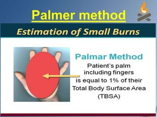 Palmer method
 