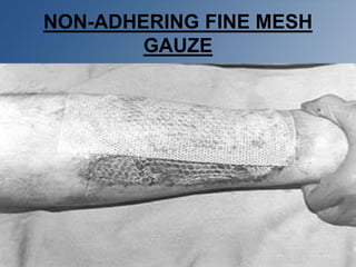 NON-ADHERING FINE MESH
GAUZE
 
