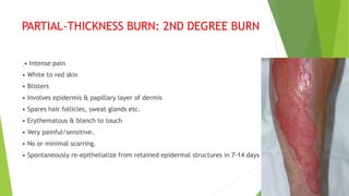 PARTIAL-THICKNESS BURN: 2ND DEGREE BURN
• Intense pain
• White to red skin
• Blisters
• Involves epidermis & papillary layer of dermis
• Spares hair follicles, sweat glands etc.
• Erythematous & blanch to touch
• Very painful/sensitive.
• No or minimal scarring.
• Spontaneously re-epithelialize from retained epidermal structures in 7-14 days
 