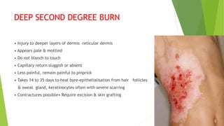 DEEP SECOND DEGREE BURN
• Injury to deeper layers of dermis –reticular dermis
• Appears pale & mottled
• Do not blanch to touch
• Capillary return sluggish or absent
• Less painful, remain painful to pinprick
• Takes 14 to 35 days to heal byre-epithelialisation from hair follicles
& sweat gland, keratinocytes often with severe scarring
• Contractures possible• Require excision & skin grafting
 