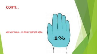 CONTI..
AREA OF PALM = 1% BODY SURFACE AREA
 