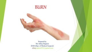 BURN
Prepared by
Mr.Abhay Rajpoot
HOD (Dep. of Medical Surgical)
abhayrajpoot5591@gmail.com
 