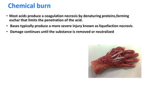Chemical burn
• Most acids produce a coagulation necrosis by denaturing proteins,forming
eschar that limits the penetration of the acid.
• Bases typically produce a more severe injury known as liquefaction necrosis.
• Damage continues until the substance is removed or neutralized
 