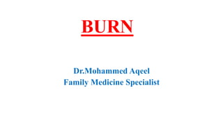 BURN
Dr.Mohammed Aqeel
Family Medicine Specialist
 
