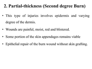 2. Partial-thickness (Second degree Burn)
• This type of injuries involves epidermis and varying
degree of the dermis.
• Wounds are painful, moist, red and blistered.
• Some portion of the skin appendages remains viable
• Epithelial repair of the burn wound without skin grafting.
 