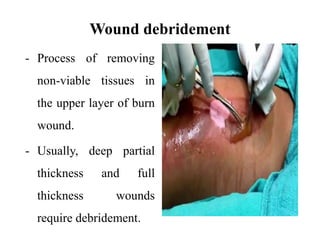 Wound debridement
- Process of removing
non-viable tissues in
the upper layer of burn
wound.
- Usually, deep partial
thickness and full
thickness wounds
require debridement.
 
