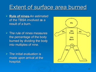 Extent of surface area burned Rule of   nines - An estimated of the TBSA involved as a result of a burn. The rule of nines measures the percentage of the body burned by dividing the body into multiples of nine. The initial evaluation is made upon arrival at the hospital. 