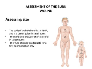 ASSESSMENT OF THE BURN
WOUND
Assessing size
• The patient’s whole hand is 1% TBSA,
and is a useful guide in small burns
• The Lund and Browder chart is useful
in larger burns
• The ‘rule of nines’ is adequate for a
first approximation only
 