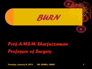 Prof. AMSM Sharfuzzaman
Professor of Surgery

Tuesday, January 8, 2013   DR. RUBEL, SBMC   1
 